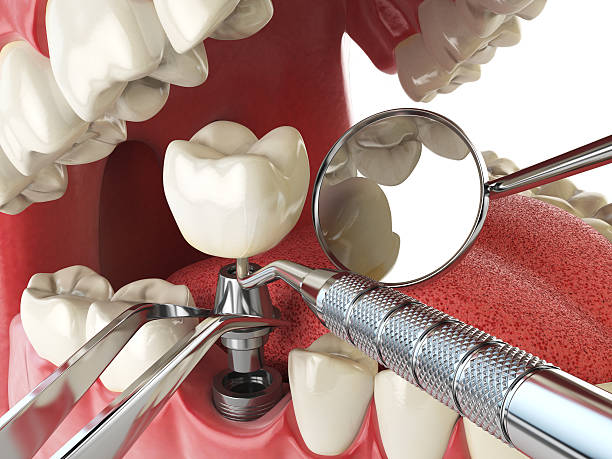 Best Same-Day Emergency Dental Services in La Verne, CA